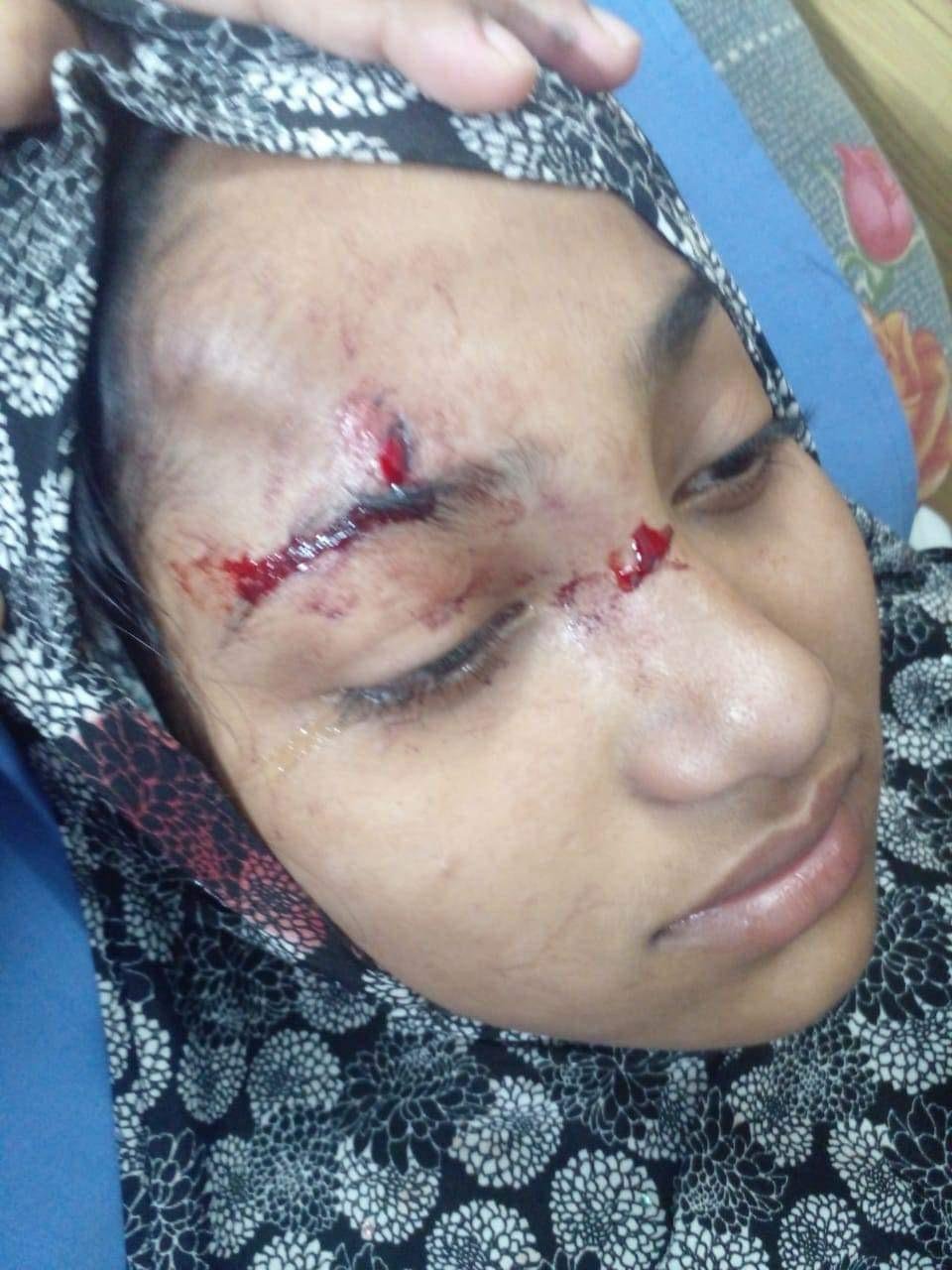 মৌলভীবাজারে জামায়াত নেতার বোনের উপর ছাত্রলীগ নেতাদের অতর্কিত হামলা