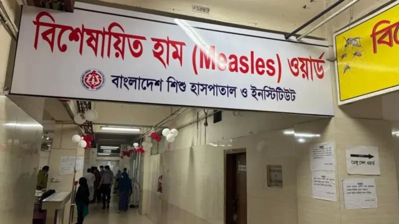 দেশে ২৪ ঘণ্টায় হাম ও উপসর্গে ১৭ মৃত্যু, হাসপাতালে ভর্তি ১,৪৫৬